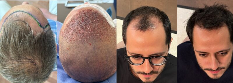 "Su objetivo es nutrir, fortalecer y estimular el crecimiento capilar, siendo una excelente opción para personas con caída del cabello, afinamiento capilar o debilidad en los folículos."