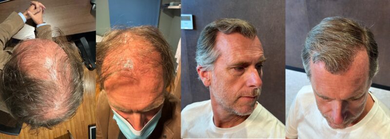 comprometido con la excelencia, asegurando un tratamiento seguro, efectivo y adaptado a tus necesidades. Redescubre tu imagen con la confianza de estar en manos expertas.